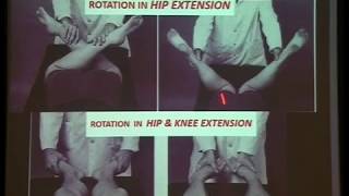 Gopalan Examination of the Hip Joint [upl. by Suirada]