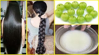 How To Grow Long amp Thicken Hair With Amla  Fast HAIR GROWTH  Stop HAIR LOSS Completely [upl. by Lativa]