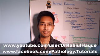 Infective Endocarditis Part 2 HD [upl. by Krenn]