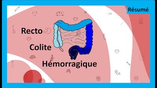 Questce que la rectocolite hémorragique 🤢💩  Résumé  HépatoGastroEntérologie [upl. by Ahsatsan]