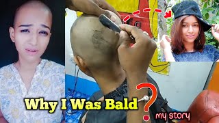 My Head Shave Story 😭  Why I was bald  wonder trisha [upl. by Erlin]