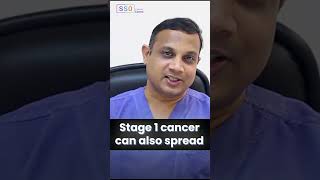 The Stages of Colon Cancer Progression amp Early Treatment  Dr Nilesh Chordiya [upl. by Eleni]