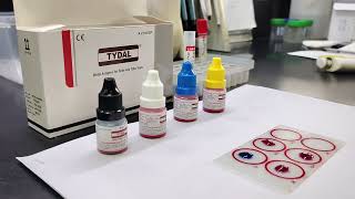 How to do WIDAL Test  Benifits of WIDAL tests  Test for Typhoid widaltest labtest [upl. by Ariaic459]