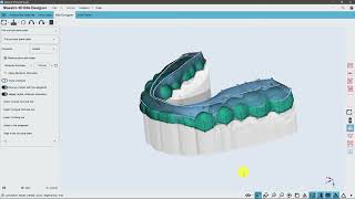 Maestro 3D  Dental Studio  Bite Splint [upl. by Dabney]