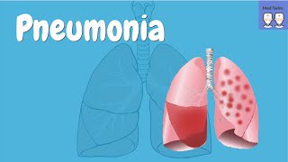 Pneumonia overview Pathophysiology Community vs Hospital acquired Symptoms CURB65 [upl. by Drofdeb]