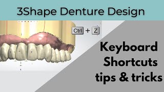 3Shape Denture Design Keyboard shortcuts [upl. by Mloclam]