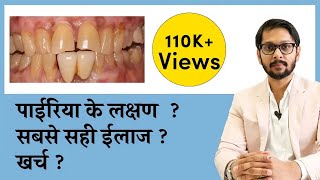 पायरिया क्या है  इसके कारण लक्षण और इलाज । pyriya  periodontitis causes symptoms amp treatment [upl. by Epul]