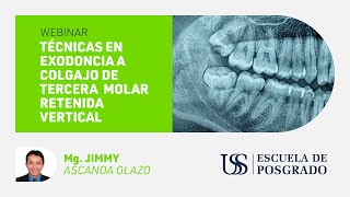 Webinar USS Técnicas en exodoncia a colgajo de tercera molar retenida vertical [upl. by Hannahoj]