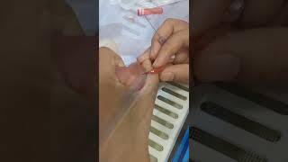 cannulation technique for Newborn  Iv cannulation nursingpracticallife [upl. by Arraic]