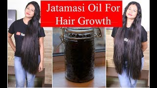 Hair fall Treatment  Hair Loss Treatment for Men  How to stop hair fall  Hair RegrowthNUTRIENTS [upl. by Shaya]