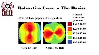 Basics of Astigmatism [upl. by Valorie487]