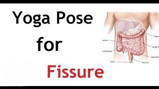 Yoga poses for Anal Fissure [upl. by Hareenum483]