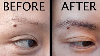 How to grow Thicker Eyebrows damaged from plucking [upl. by Joycelin]