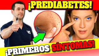 PREDIABETES y RESISTENCIA a INSULINA SÍNTOMAS INICIALES [upl. by Nnav]