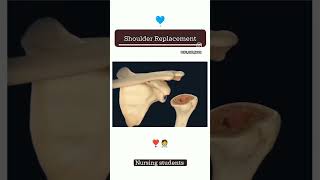 How to work glenoid cavity and head of humerus Dr Gunjan singh [upl. by Holli]