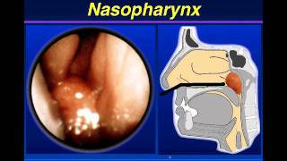 Rhinolaryngoscopy William Dolen MD [upl. by Ydne607]