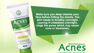 ACNES CREAMY WASH [upl. by Kimber564]