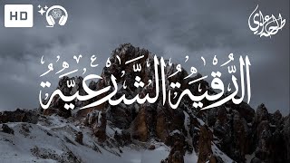 Ruqyah Shariah  Talha Alvi  الرقية الشرعية  طلحة علوي [upl. by Yemrots]