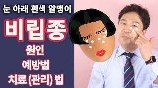 비립종 원인 예방법 치료방법 제거방법 깐달걀 눈가피부 만들기 by 핑피박 [upl. by Saks]