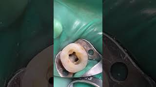 endodontist endodontics rootcanaltreatment rootcanaltherapy [upl. by Evaleen]