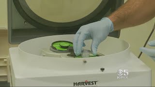 Stanford Doctors Regenerate Knee Cartilage Using Patients Stem Cells [upl. by Ainesej]