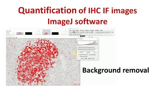 Quantification of Immunohistochemistry images using ImageJ  How to remove background in ImageJ [upl. by Kirtap]