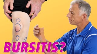 What Is Causing Your Knee Pain Bursitis How To Tell [upl. by Riess547]