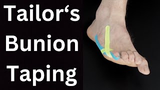 Tailors Bunion Pain Relief Taping [upl. by Anilejna]