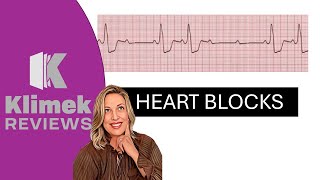 HEART BLOCKS  questions with Dr Sharon [upl. by Enelaj]