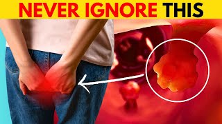 7 Signs and Symptoms Of Colon Cancer MUST WATCH [upl. by Ylluz874]