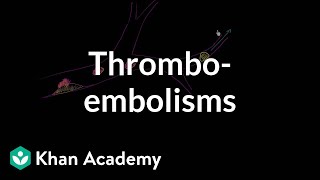 Thromboemboli and thromboembolisms  Miscellaneous  Heatlh amp Medicine  Khan Academy [upl. by Lula952]