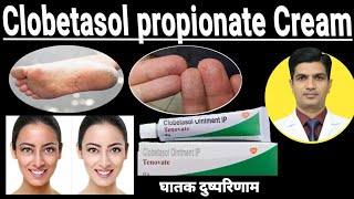 Clobetasol Cream ip tenovate  Clobetasol propionate cream [upl. by Adnohr]