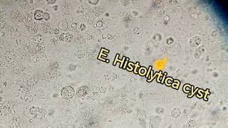 Entamoeba Histolytica trophozoite cyst Stool examination stoolanalysis gse stooltest [upl. by Samoht27]