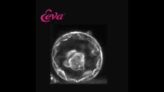 Embryo Development Day 5 Using The Eeva Test [upl. by Newsom]