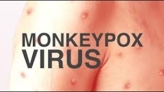 New disease monkeypox disease [upl. by Donough]