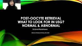 Post oocyte retrieval What to look for in USG [upl. by Letti]