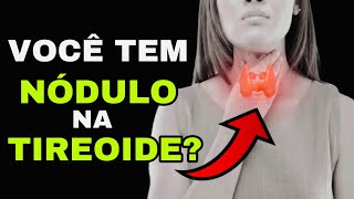 Como Tratar Nódulos Da Tireoide Dr Rogério Leite [upl. by Hippel]