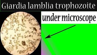 Giardia lamblia trophozoite under microscope In stool sample [upl. by Rozanna978]