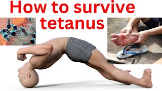 How to survive tetanus  tetanus treatment and cure tetanus sympyoms and prevention [upl. by Kennard]