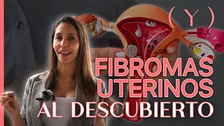 FIBROMAS UTERINOS AL DESCUBIERTO  Doctora Catalina Agudelo [upl. by Amaso217]