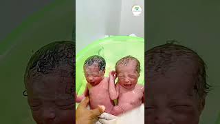 Twins Baby in the First Bath  newbornbaby cutebaby normaldeliverytips pregnancytips littlebaby [upl. by Reel480]