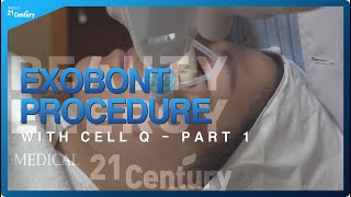 ExoBont Procedure  with CELL Q Part 1  21 Century Medical [upl. by Lezned]