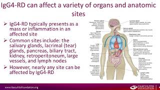 IgG4 Related Disease [upl. by Longan]