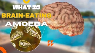 Brain Eating Amoeba Naegleria fowleri [upl. by Arannahs712]