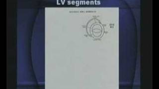 Basics Of Echocardiography Part1series2 [upl. by Ahsei]