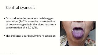 Cyanotic Congenital Heart Disease En  Soha Romeih [upl. by Coshow]