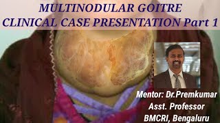 MULTINODULAR GOITRE Clinical case presentation  Part 1 [upl. by Becka189]