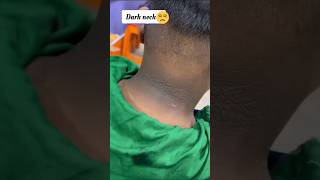 🤯Neck Cleaning Tips Get Rid of Dark NeckDark Neck Home Remedies💯😍shortsytshortsviralskincare [upl. by Ferwerda]