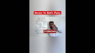 The Key Difference in Diagnosing a Stroke vs Bell’s Palsy  Brain Expert Explains [upl. by Rubbico]