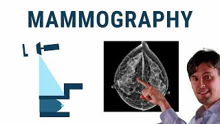 Mammography Xray Physics [upl. by Pol]